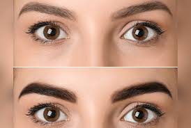 Eyebrow Pigmentation Image